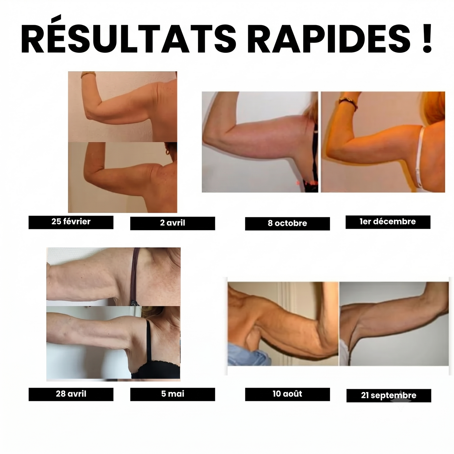 Manchons de compression 3D Glowora™ – Dites adieu aux mouvements incontrôlés des bras