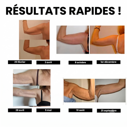 Manchons de compression 3D Glowora™ – Dites adieu aux mouvements incontrôlés des bras